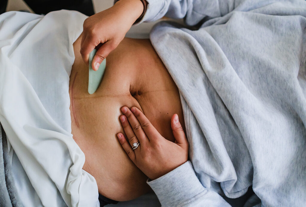 C-section scar massage class