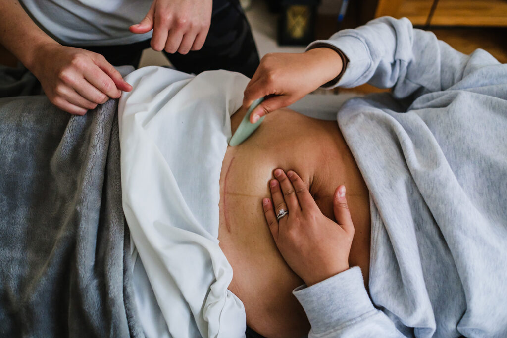 C Section Scar Massage Therapist