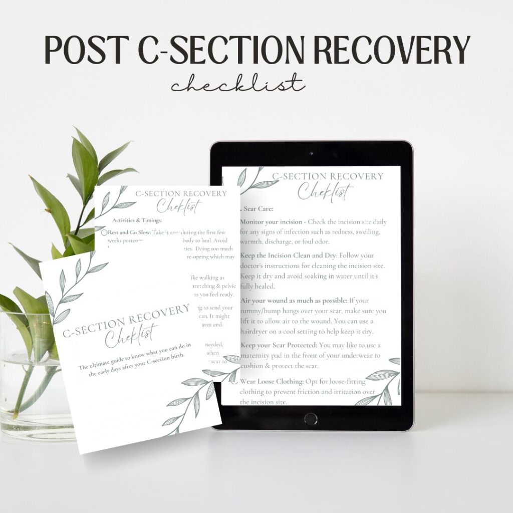 Post C-Section Recovery Checklist